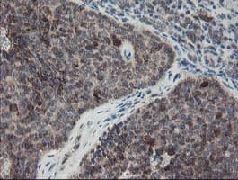 SKIL / SNO / SnoN Antibody (clone OTI1A6)