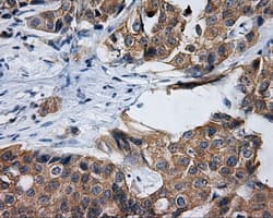 Monoclonal Mouse anti-Human RIP1 / RALBP1 Antibody (clone OTI2A6, IHC, IF, WB)