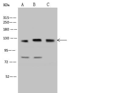 SREBF2 / SREBP2 Antibody