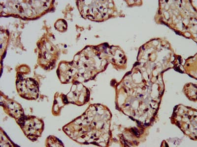 MC3R / MC3 Receptor Antibody
