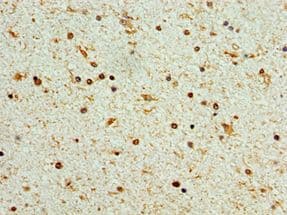 STK32A Antibody (aa1-166)