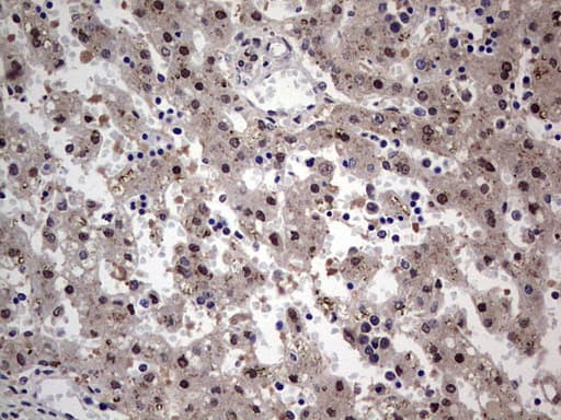 SETD2 Antibody (aa1787-2144, clone OTI1E1)