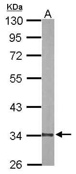 IHC-plus™ DECR1 Antibody (aa1-335)