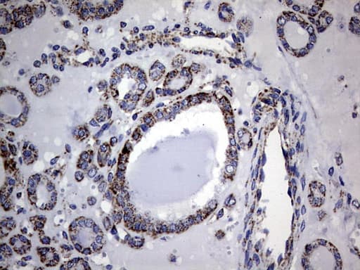 PIK3CD / PI3K Delta Antibody (aa286-610, clone OTI6A12)