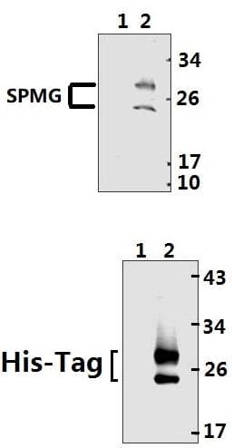 SARS-CoV-2 M Glycoprotein Antibody (aa 183-199)