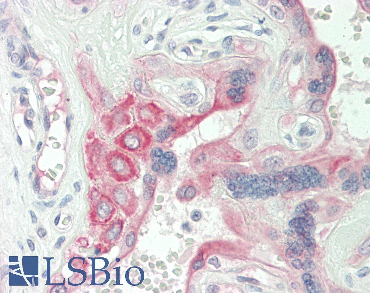 Polyclonal Rabbit anti-Rat FGF3 Antibody (aa160-209, IHC, WB)