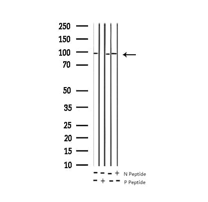 INSR / Insulin Receptor Antibody (phospho-Tyr1361)