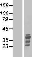 TLX1 / HOX11 Protein (Over-Expression Lysate Myc-DDK (Flag))