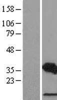 CDCA3 Protein (Over-Expression Lysate Myc-DDK (Flag))