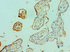 Polyclonal Rabbit anti-Human FOXP2 Antibody (aa416-715, IHC)