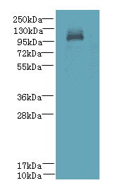 DENND2C Antibody