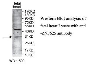 ZNF625 Antibody (aa37-296)