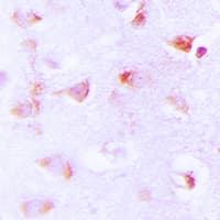 Polyclonal Rabbit anti-Human Acetyl-CoA Carboxylase / ACC Antibody (phospho-Ser80, IHC, WB)