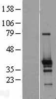ZNF524 Protein (Over-Expression Lysate Myc-DDK (Flag))