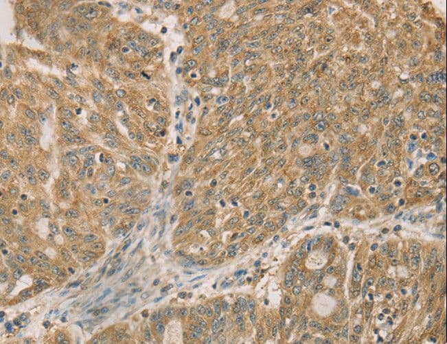 DMRTA3 / DMRT3 Antibody