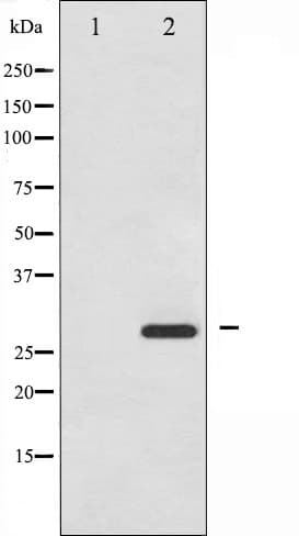 HSPB1 / HSP27 Antibody (phospho-Ser15)