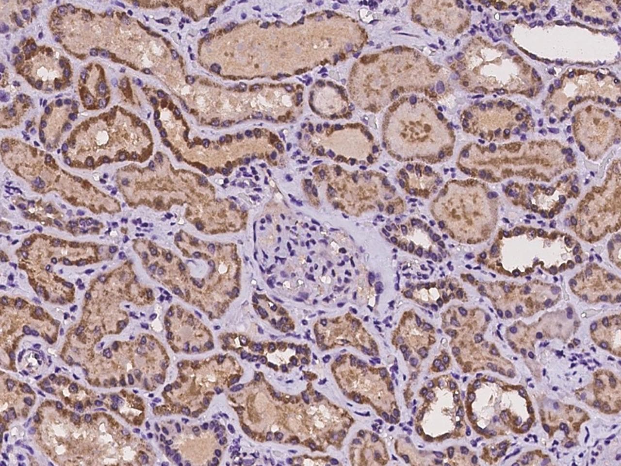 Polyclonal Rabbit anti-Human CLPB Antibody (IHC)