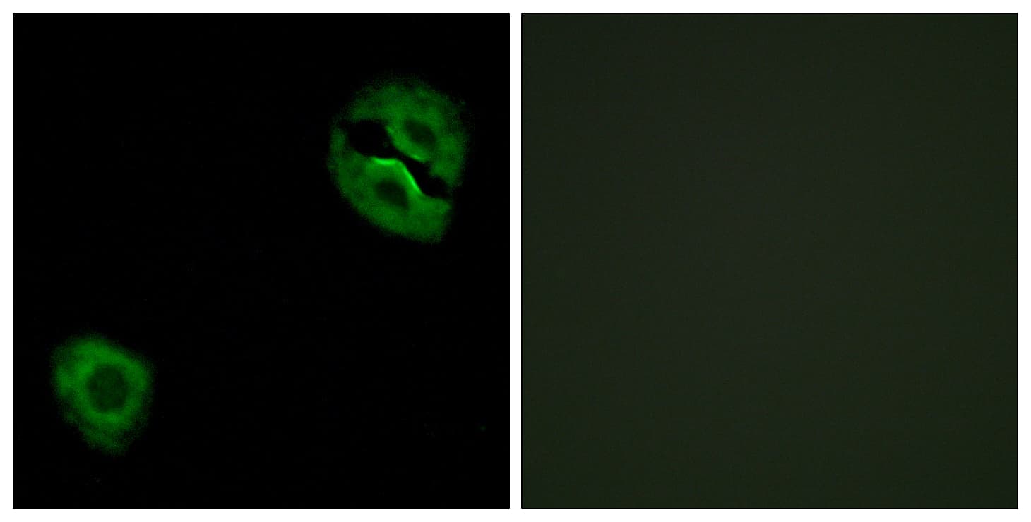 COL19A1 / Collagen XIX Antibody (aa421-470)