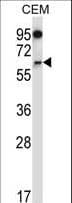 Polyclonal Rabbit anti-Human NOX4 Antibody (aa124-153, IHC, WB)