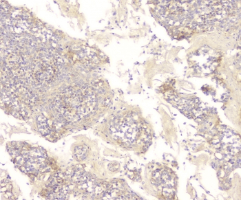 CCR10 / GPR2 Antibody