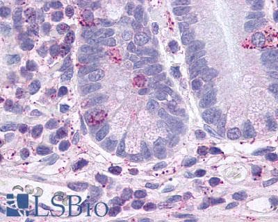 PathPlus™ GLP2R Antibody (C-Terminus)