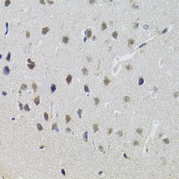 STAT1 Antibody