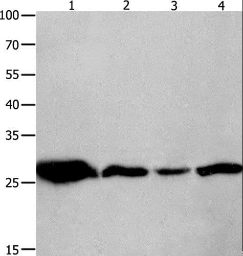 Polyclonal Rabbit anti-Human YWHAQ / 14-3-3 Theta Antibody (IHC, WB)