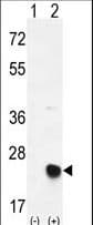 MSRB2 / MSRB Antibody (aa44-73)