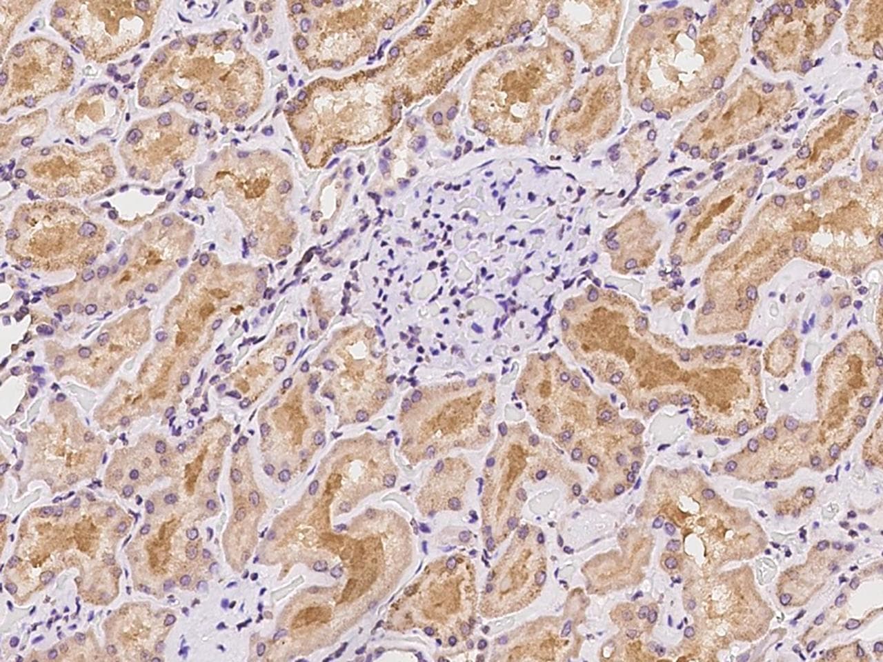 ALDH6A1 Antibody