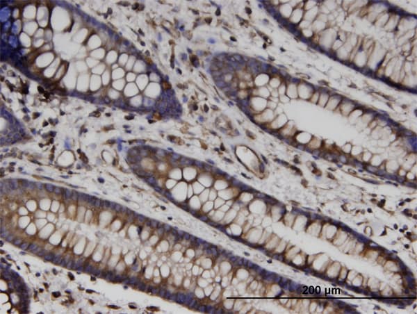 TUBB / Beta Tubulin Antibody (clone 3B3)