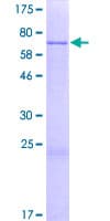 Human PNKD Protein (Recombinant GST)