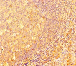 Polyclonal Rabbit anti-Human IRF5 Antibody (IHC, IF, WB)