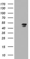Monoclonal Mouse anti-Human MEIS3 Antibody (clone OTI3C9, IHC, WB)