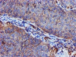 EPN2 Antibody (clone OTI1E4)