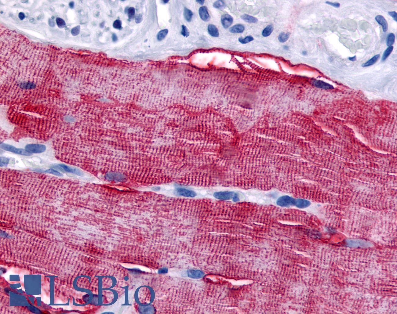 IHC-plus™ GRK5 Antibody (Internal)