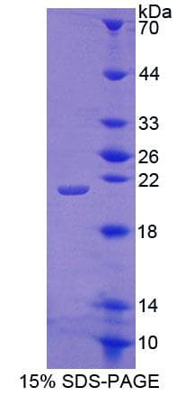 Mouse ACD / PTOP Protein (Recombinant His-T7)