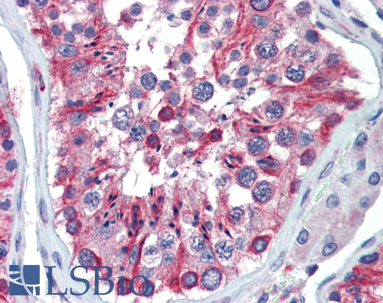 LIN28A / LIN28 Antibody (N-Terminus)