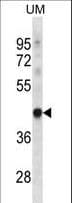 TRUB1 Antibody (aa152-180)