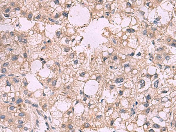 KCNIP1 / KCHIP1 Antibody