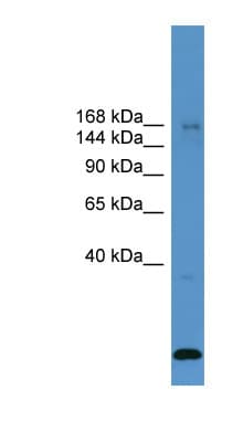 Polyclonal Rabbit anti-Human USP47 Antibody (aa901-950, WB)