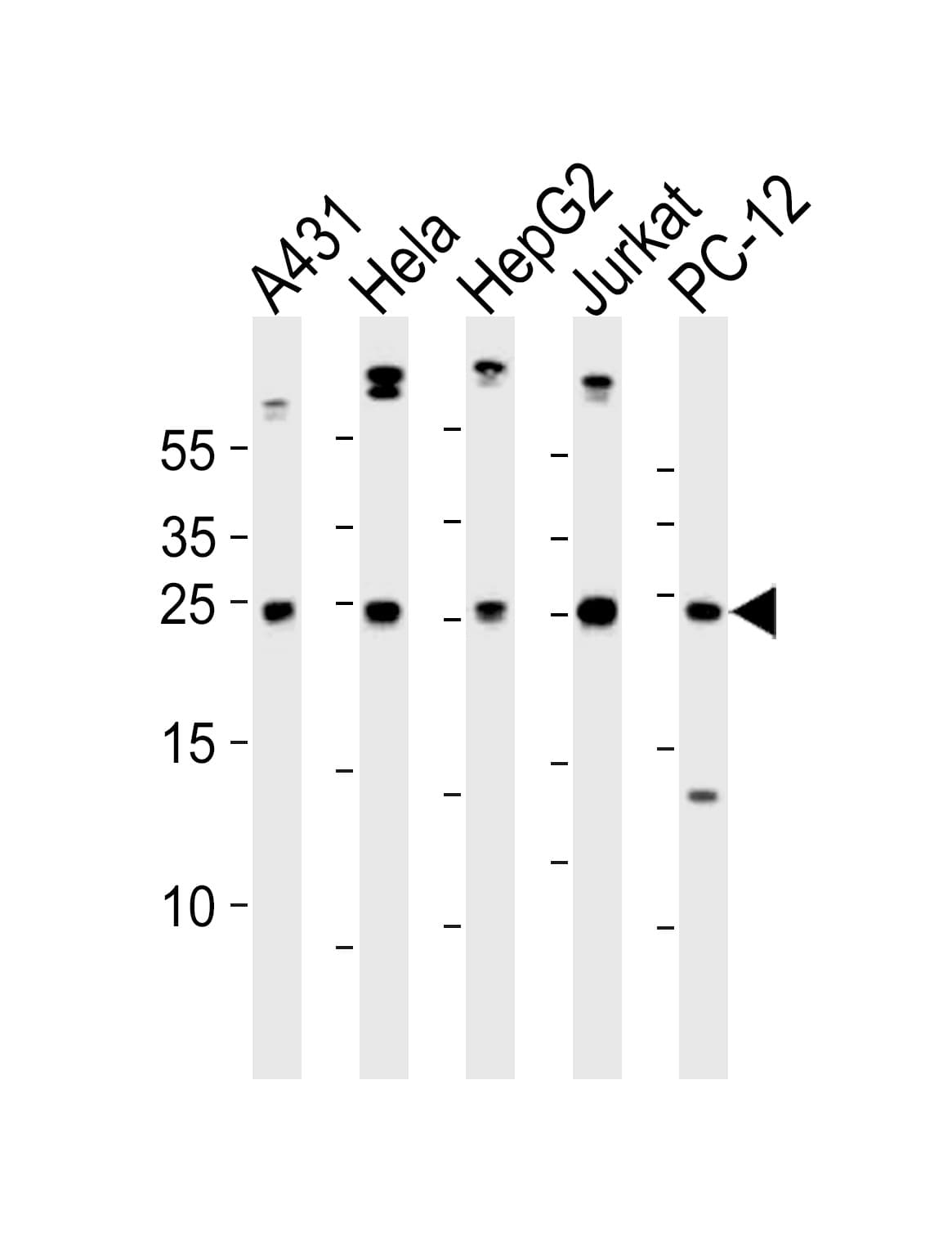 Polyclonal Rabbit anti-Human BCL2L1 / BCL-XL Antibody (aa195-229, WB)