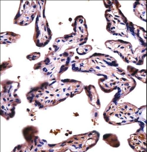 Polyclonal Rabbit anti-Human DPY19L4 Antibody (aa1-30, IHC, WB)