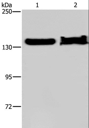 KDM4A / JHDM3A / JMJD2A Antibody