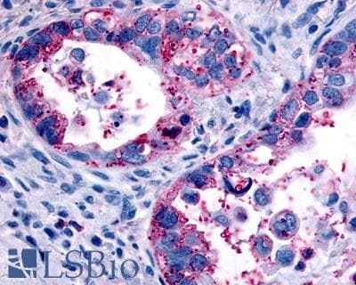 PathPlus™ Polyclonal Rabbit anti-Human OXTR / Oxytocin Receptor Antibody (Cytoplasmic Domain, IHC)