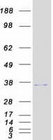 Human CHMP4C Protein (Recombinant Myc-DDK (Flag))