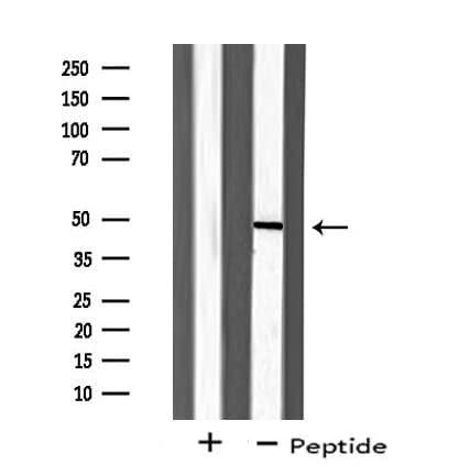 Polyclonal Rabbit anti-Human ZAR1 Antibody (IF, WB)