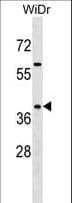 Polyclonal Rabbit anti-Human SYAP1 Antibody (aa210-238, WB)