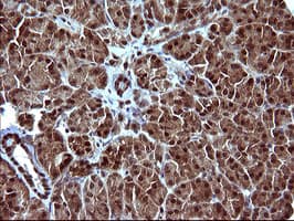 UPRT Antibody (clone OTI2D1)