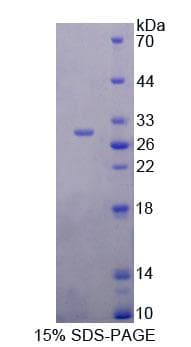 Human EIF4H Protein (Recombinant His-T7, N-terminus)