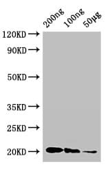 IFN Gamma / Interferon Gamma Antibody